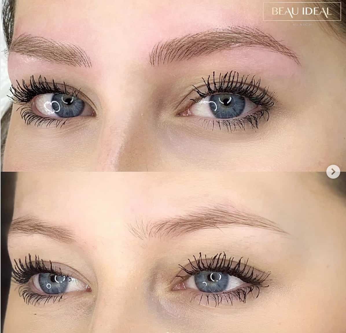Microblading-before-after