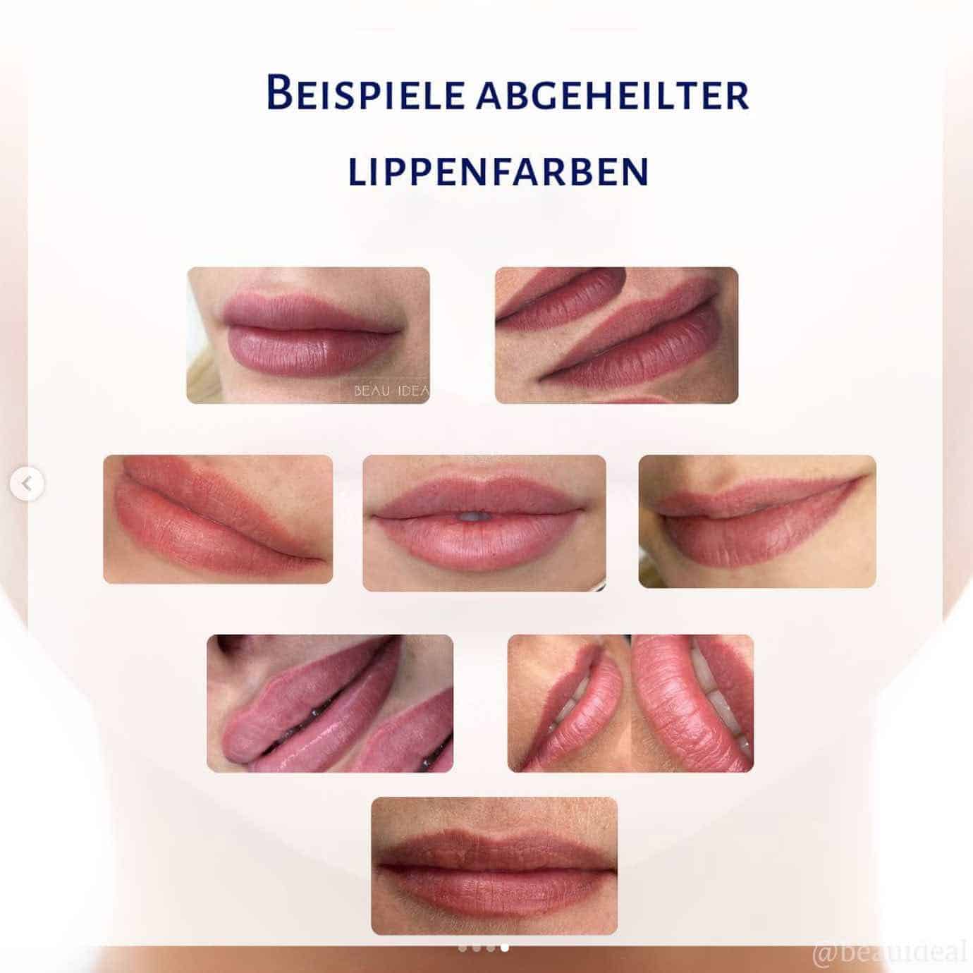beauideal_lips_abgeheilt